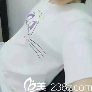 在北京知音做脂肪豐胸前樣子 在北京知音做脂肪豐胸前樣子