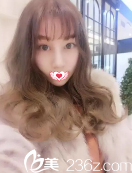 今天將自己在邢臺媚思嘉做硅膠隆鼻后改善低鼻梁和寬鼻翼的恢復(fù)經(jīng)歷分享給大家