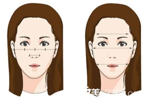 韓國張益秀整形外科顴骨整形