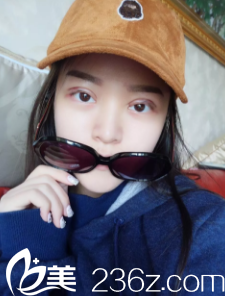 剛做完雙眼皮手術(shù)眼睛腫脹 剛做完雙眼皮手術(shù)眼睛腫脹