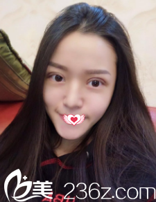 術(shù)后4天眼睛疼痛感消失 術(shù)后4天眼睛疼痛感消失