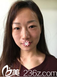 以前顯老的我 以前顯老的我