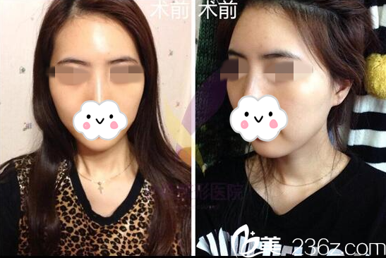 手術(shù)前的我 手術(shù)前的我