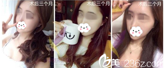 術(shù)后三個(gè)月 術(shù)后三個(gè)月