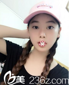 術(shù)前的我 術(shù)前的我