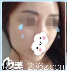 手術(shù)前的我 手術(shù)前的我