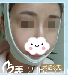 術(shù)后第三天 術(shù)后第三天