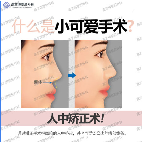 韓國高蘭得小可愛手術