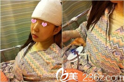 假體隆胸手術前照片 假體隆胸手術前照片