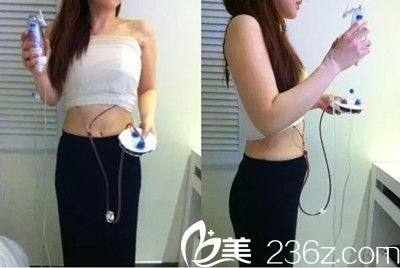 假體隆胸手術后一周 假體隆胸手術后一周