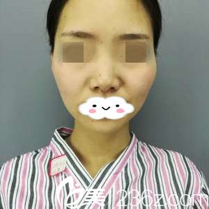 手術(shù)前的我 手術(shù)前的我