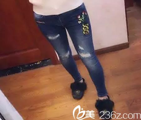 真實(shí)案例揭曉韓國來福琳整形醫(yī)院崔榮桓院長大腿吸脂手術(shù)全過程