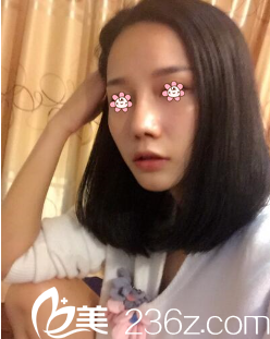 重慶美侖美奐姬廣翰隆鼻好嗎