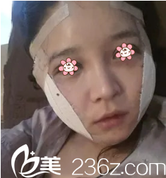 金壽信院長給我做完手術(shù)后第三天 金壽信院長給我做完手術(shù)后第三天