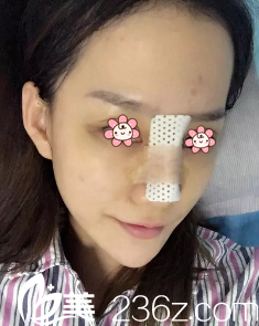 修復(fù)術(shù)后第五天