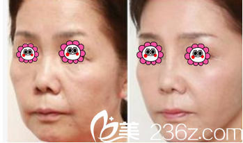 韓國(guó)韓美人<!--<i data=20240703-sp></i>-->美膚案例 韓國(guó)韓美人<!--<i data=20240703-sp></i>-->美膚案例