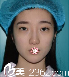 術(shù)前我變成一單一雙 術(shù)前我變成一單一雙