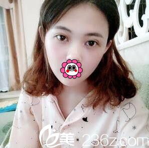 直播整形醫(yī)院蔣新力給我做3D媚眼綜合手術(shù)恢復(fù)全過程