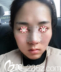 術(shù)后三天的樣子