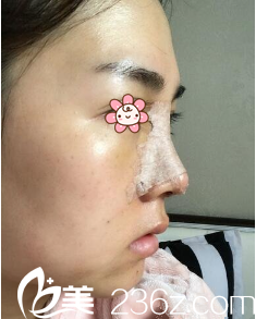 鄭鎬勛院長給我做完手術(shù)后第六天