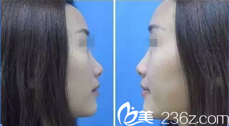 手術(shù)前的我 手術(shù)前的我