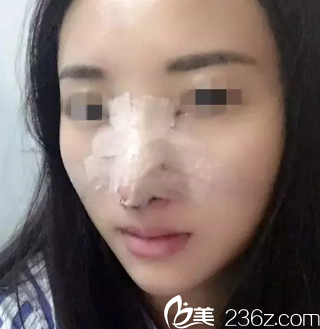 術(shù)后當天 術(shù)后當天