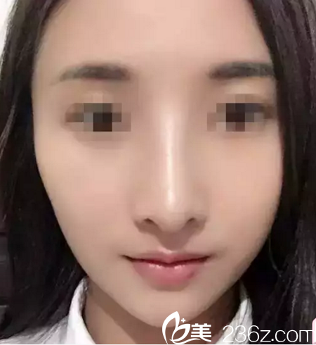 術(shù)后一周 術(shù)后一周