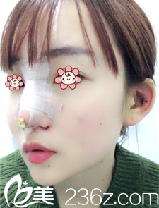 手術(shù)做完后第三天 手術(shù)做完后第三天