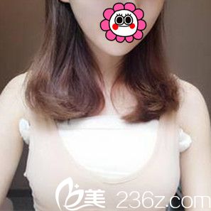 假體隆胸術后3天效果 假體隆胸術后3天效果