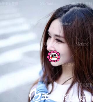 真沒(méi)想到我在大連新華美天做了眼鼻部綜合整形后，變化竟然這么大！