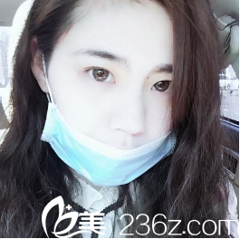 我的術前照 我的術前照