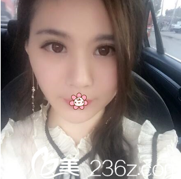 去年3月18號(hào)在韓國(guó)i-Line整形外科做的雙眼皮+開(kāi)眼角效果是我較滿意的一次！