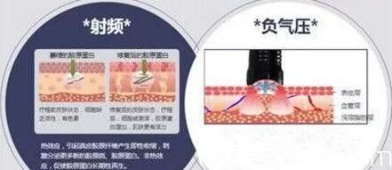 ?？诿捞m紅妝醫(yī)學(xué)美容魔法吸脂術(shù)