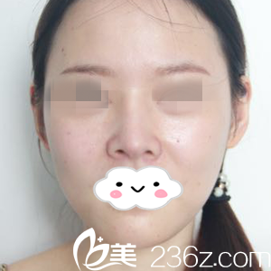 手術前的我 手術前的我