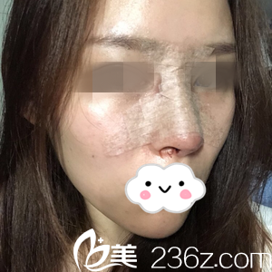 手術當天 手術當天