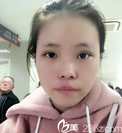 西安晶膚醫(yī)療美容醫(yī)院國慶大促，只需要399，玻尿酸隆鼻980