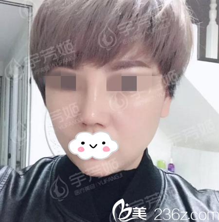 術(shù)后半個(gè)月