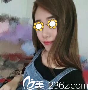 自體脂肪填充全臉術(shù)后半個月<span style=