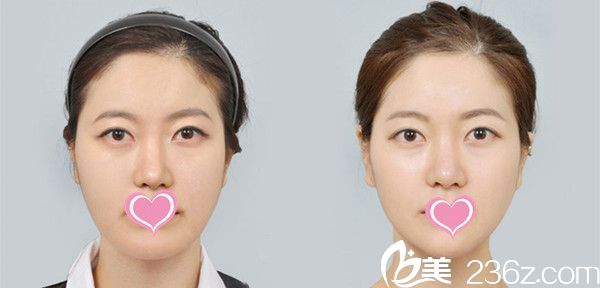 面部輪廓+眼睛+鼻子