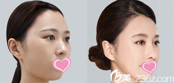 面部輪廓+眼睛+鼻子+嫩膚