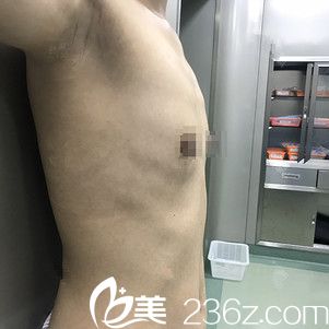 無錫坤如瑪麗整形美容醫(yī)院趙斌術(shù)前照片1