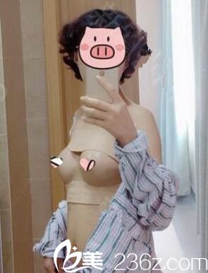 術(shù)后四天假體隆胸恢復(fù)中 術(shù)后四天假體隆胸恢復(fù)中