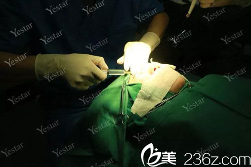 術(shù)前雙眼皮做局麻 術(shù)前雙眼皮做局麻