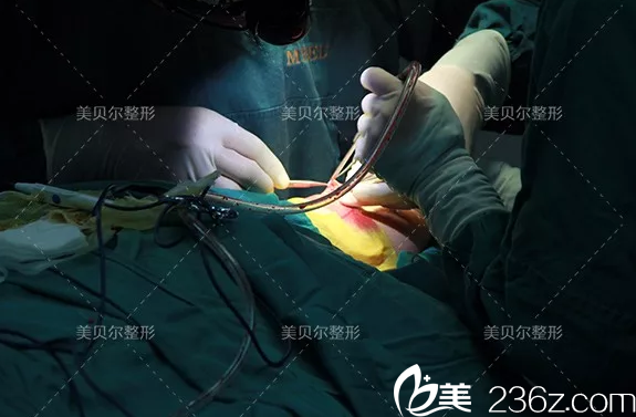 鼻綜合整形手術(shù)中