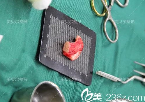 取出備用的肋軟骨材料