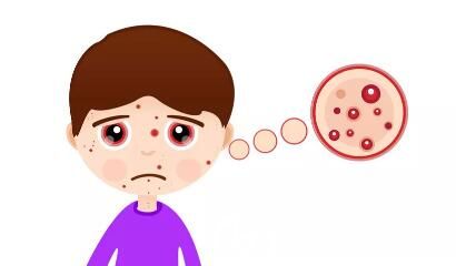 皮膚過敏的主要表現(xiàn)形式