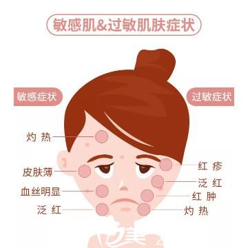 敏感皮膚和皮膚過敏的癥狀對(duì)比
