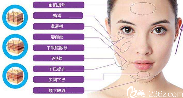 線雕可以做哪些部位