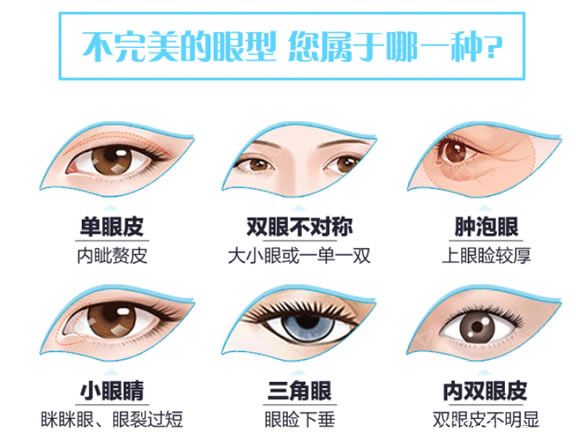 不漂亮眼型分類 不漂亮眼型分類