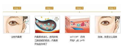 瘦臉除皺去除魚尾紋原理
